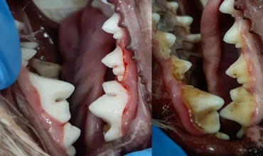 Ağız ve Diş Sağlığı